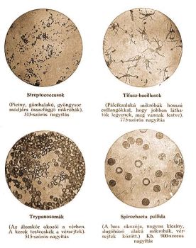 Különféle mikróbák mikrofotografái II.
